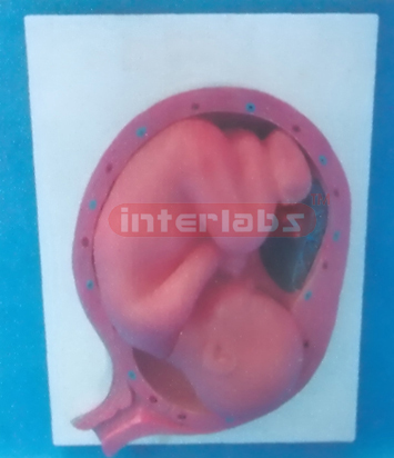 UTERUS WITH EMBRYO (9 MONTH)